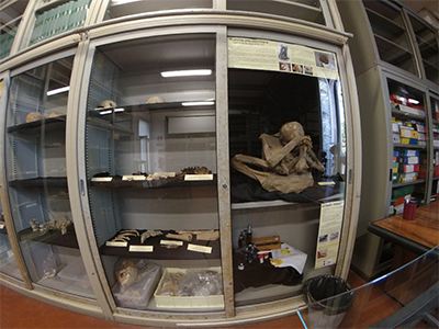 Pisa Museo di Anatomia Patologica