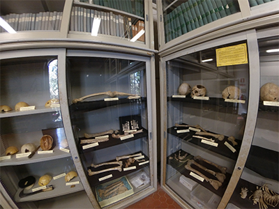 Museo Anatomia Patologica